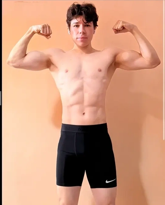 Caso 4