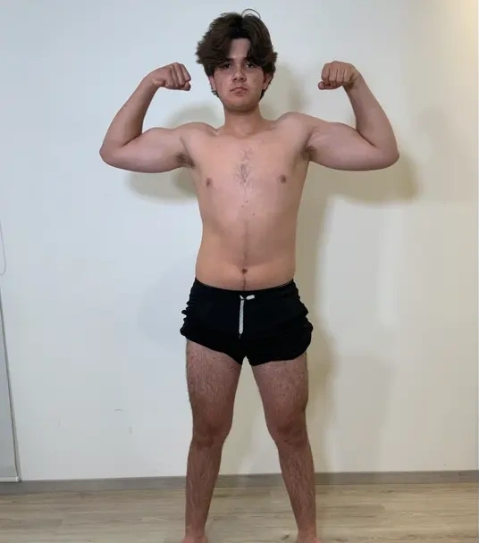 Caso 7