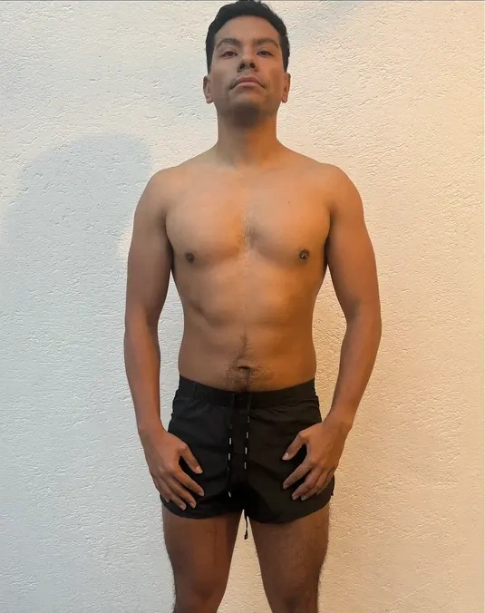 Caso 47
