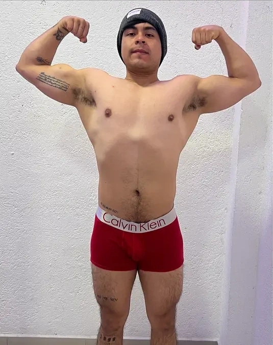 Caso 69